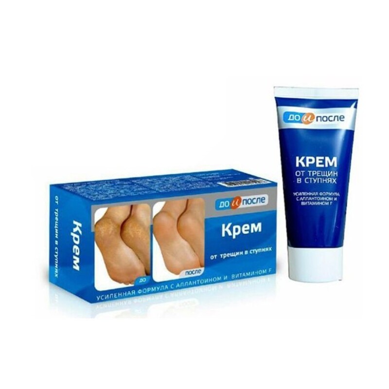 Kpem Tuýp 100ml – Dưỡng Ẩm